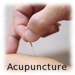 acupuncture
