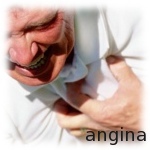 angina