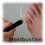 moxibustion